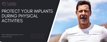 Protect your implants during physical activities