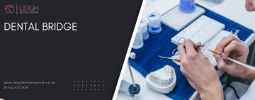 Dental bridge