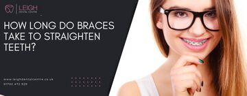 How long do braces take to straighten teeth