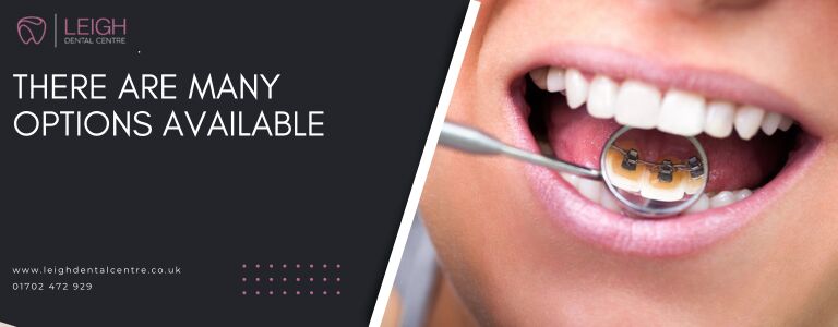 What Adults Should Know About Teeth… | Leigh Dental Centre