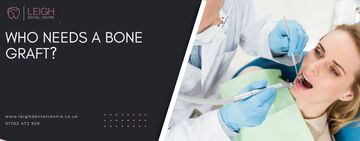 Who needs a bone graft?