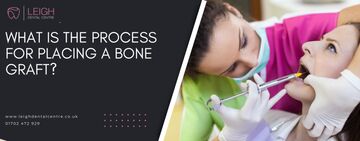 What is the process for placing a bone graft?
