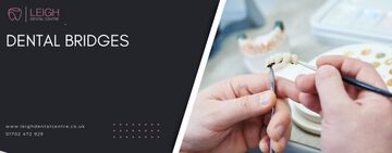 Dental Bridges