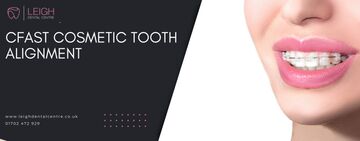 Cfast Cosmetic Tooth Alignment