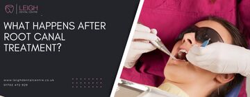 What happens after root canal treatment