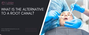 What is the alternative to a root canal