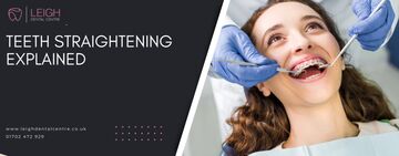 Teeth straightening explained