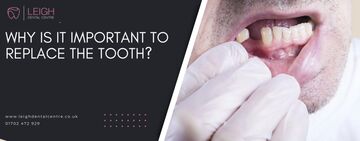 Why is it important to replace the tooth