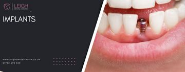 Implant in mouth