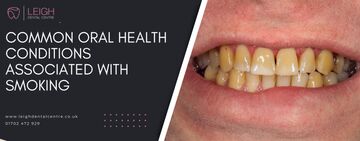 Common oral health conditions associated with smoking