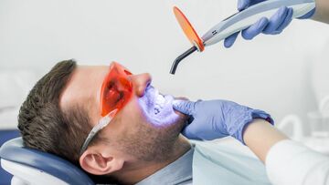 Keeping Your Teeth White Following Teeth Whitening