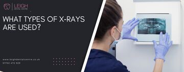 What types of X‑Rays are used