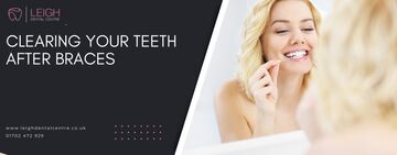 Clearing your teeth after braces