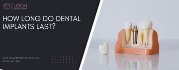 How long do dental implants last